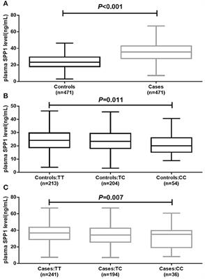 A Case-Control Study of the Association Between the SPP1 Gene SNPs and the Susceptibility to Breast Cancer in Guangxi, China